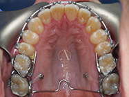 Progressive - Ali Orthodontics Dental