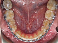 Progressive - Ali Orthodontics Dental