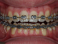 Progressive - Ali Orthodontics Dental