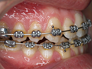 Progressive - Ali Orthodontics Dental