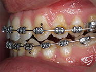 Progressive - Ali Orthodontics Dental