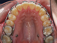 Progressive - Ali Orthodontics Dental