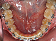 Progressive - Ali Orthodontics Dental