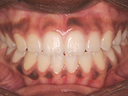 Progressive - Ali Orthodontics Dental