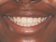 Progressive - Ali Orthodontics Dental