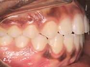 Progressive - Ali Orthodontics Dental