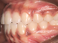 Progressive - Ali Orthodontics Dental