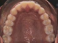 Progressive - Ali Orthodontics Dental