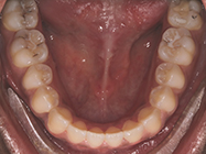 Progressive - Ali Orthodontics Dental