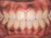 After - Ali Orthodontics Dental