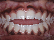 Progressive - Ali Orthodontics Dental