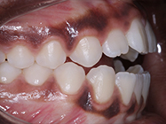 Progressive - Ali Orthodontics Dental