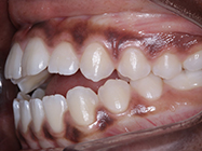 Progressive - Ali Orthodontics Dental