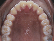 Progressive - Ali Orthodontics Dental