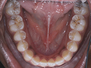 Progressive - Ali Orthodontics Dental