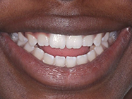 Progressive - Ali Orthodontics Dental