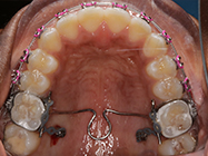 Progressive - Ali Orthodontics Dental