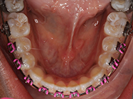 Progressive - Ali Orthodontics Dental