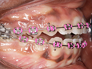 Progressive - Ali Orthodontics Dental