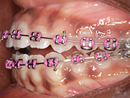 Progressive - Ali Orthodontics Dental