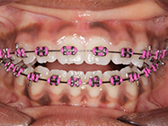 Progressive - Ali Orthodontics Dental