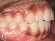 Progressive - Ali Orthodontics Dental