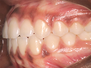 Progressive - Ali Orthodontics Dental