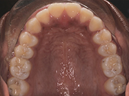 Progressive - Ali Orthodontics Dental