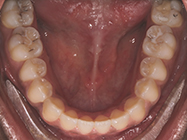 Progressive - Ali Orthodontics Dental