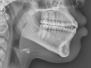 Progressive - Ali Orthodontics Dental