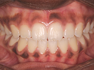 Progressive - Ali Orthodontics Dental