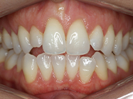 Progressive - Ali Orthodontics Dental