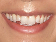 Progressive - Ali Orthodontics Dental