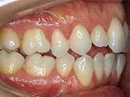 Progressive - Ali Orthodontics Dental