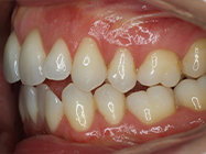 Progressive - Ali Orthodontics Dental