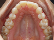 Progressive - Ali Orthodontics Dental