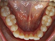 Progressive - Ali Orthodontics Dental