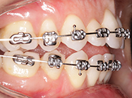 Progressive - Ali Orthodontics Dental