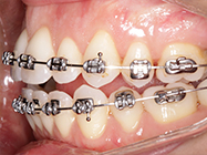 Progressive - Ali Orthodontics Dental