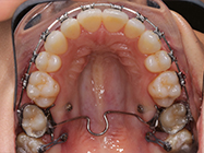 Progressive - Ali Orthodontics Dental