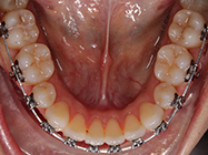 Progressive - Ali Orthodontics Dental