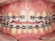 Progressive - Ali Orthodontics Dental