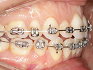 Progressive - Ali Orthodontics Dental