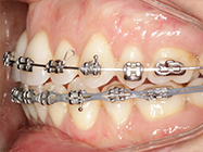 Progressive - Ali Orthodontics Dental