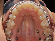 Progressive - Ali Orthodontics Dental