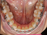 Progressive - Ali Orthodontics Dental