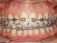 Progressive - Ali Orthodontics Dental