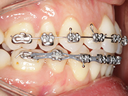 Progressive - Ali Orthodontics Dental