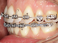 Progressive - Ali Orthodontics Dental