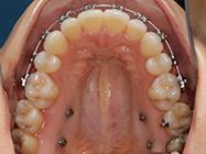 Progressive - Ali Orthodontics Dental